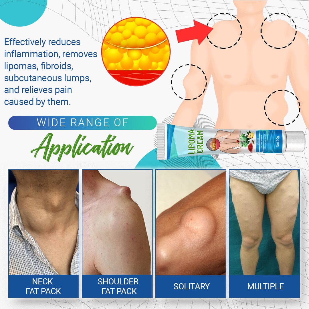 LumpFree Lipoma Removal Cream