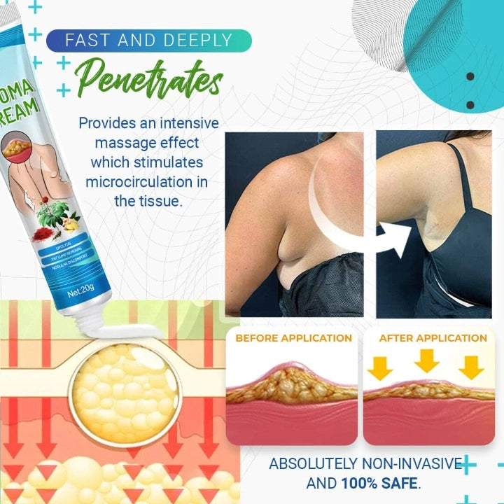 LumpFree Lipoma Removal Cream