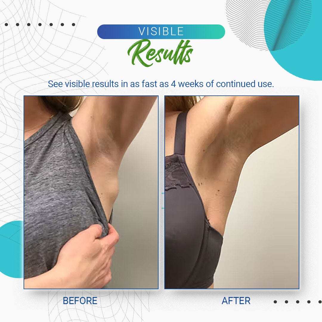 LumpFree Lipoma Removal Cream
