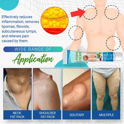 LumpFree Lipoma Removal Cream
